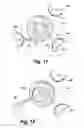 Fig. 16 - Replacement aortic valve leaflets and related technology
