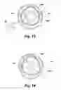 Fig. 17 - Replacement aortic valve leaflets and related technology