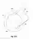 Fig. 32 - Replacement aortic valve leaflets and related technology
