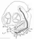 Fig. 01 - Method and apparatus for reducing mitral regurgitation