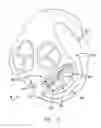 Fig. 03 - Method and apparatus for reducing mitral regurgitation