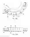 Fig. 42 - Method and apparatus for reducing mitral regurgitation