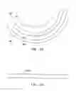 Fig. 47 - Method and apparatus for reducing mitral regurgitation