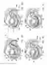 Fig. 49 - Method and apparatus for reducing mitral regurgitation