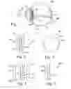 Fig. 02 - Implantable prismatic device, and related methods and systems