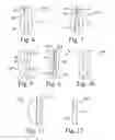 Fig. 03 - Implantable prismatic device, and related methods and systems