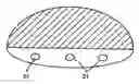 Fig. 01 - Solid implant