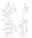 Fig. 14 - Adjustable and fixed assembled bone-tendon-bone graft