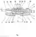 Fig. 02 - Intervertebral implant comprising dome-shaped joint surfaces