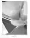 Fig. 13 - Articular surface implant