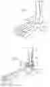 Fig. 02 - Ankle replacement system