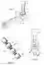 Fig. 03 - Ankle replacement system