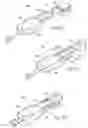 Fig. 09 - Ankle replacement system