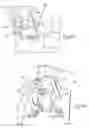 Fig. 17 - Ankle replacement system
