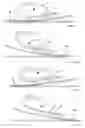 Fig. 05 - Prosthetic foot with energy transfer