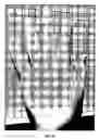 Fig. 08 - Method for creating covers for prosthetic devices and other dynamic supporting members