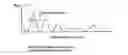 Fig. 07 - Waveform recognition method and apparatus