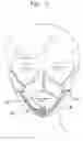 Fig. 06 - See-through mask