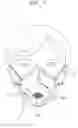 Fig. 08 - See-through mask
