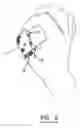 Fig. 06 - Finger protecting device and method for protecting at least one finger
