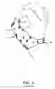 Fig. 07 - Finger protecting device and method for protecting at least one finger