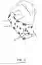 Fig. 08 - Finger protecting device and method for protecting at least one finger