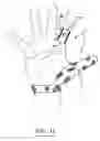Fig. 13 - Finger protecting device and method for protecting at least one finger