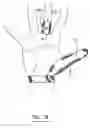 Fig. 17 - Finger protecting device and method for protecting at least one finger