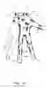 Fig. 20 - Finger protecting device and method for protecting at least one finger