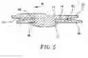 Fig. 06 - SNAP BUTTON WITH PULL-APART RESISTING STRUCTURE