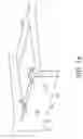 Fig. 22 - Flashing assembly with cross channels and method for same