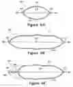 Fig. 07 - Fluid-filled bladder for footwear and other applications