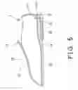 Fig. 04 - Shoe having physical measuring device