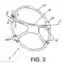 Fig. 04 - STEERING WHEEL AND METHOD OF MANUFACTURING