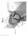 Fig. 04 - APPARATUS AND METHOD FOR ORALLY MEDICATING EQUINES