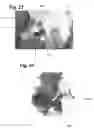 Fig. 16 - APPARATUS AND METHOD FOR ORALLY MEDICATING EQUINES