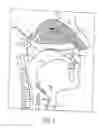 Fig. 02 - Nasal delivery device