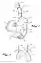 Fig. 02 - Assisted breathing device and method of wearing same