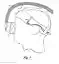 Fig. 02 - Face mask support