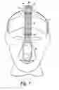 Fig. 04 - Face mask support
