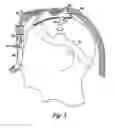 Fig. 06 - Face mask support