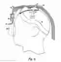 Fig. 07 - Face mask support
