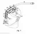 Fig. 08 - Face mask support