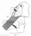 Fig. 03 - Dental operating support
