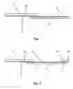 Fig. 02 - Method of wrapping elongate material, especially cable harnesses, with a sheath