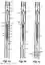 Fig. 02 - Method and apparatus for forming a window in a casing using a biasing arm