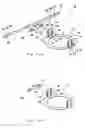Fig. 02 - Mounting support device for ceiling embedded speaker system