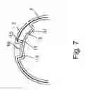 Fig. 06 - Zero-clearance packaging for elongate objects