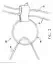 Fig. 04 - Reefing assembly for a circular parachute