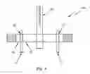 Fig. 04 - Post puller